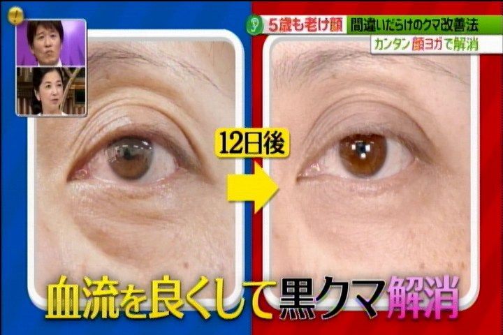 改善因皮膚衰老鬆弛而造成的黑眼圈。