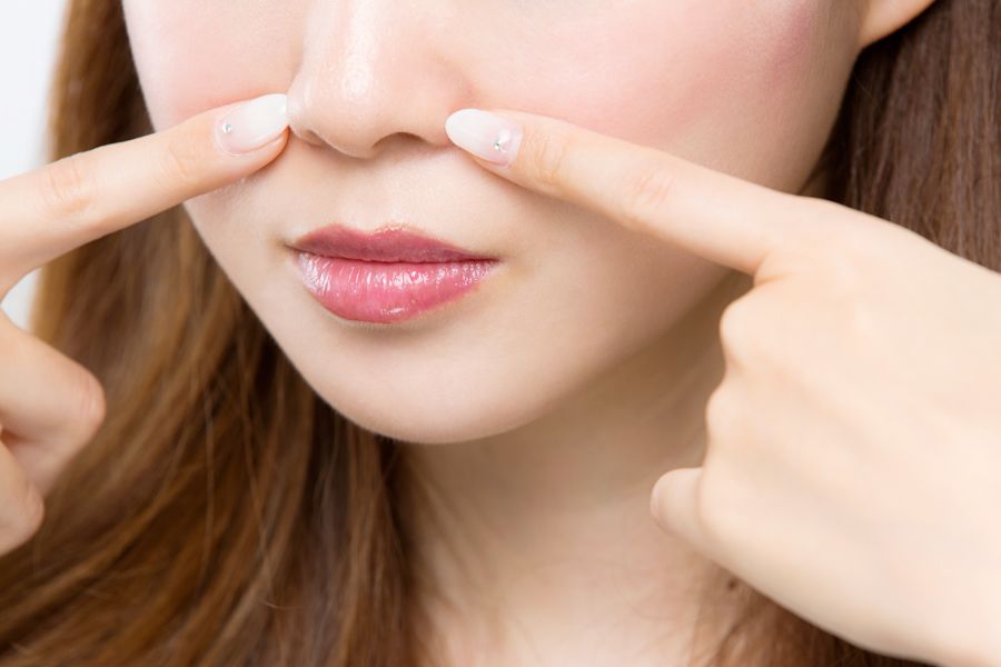 原因1：沒徹底清潔 － 化妝品容易在鼻子下累積，在鼻子下面化妝品最容易堆積，並且令皮脂分泌過多阻塞毛孔。沒徹底清潔臉部是最容易引起暗瘡痤瘡的因素之一。