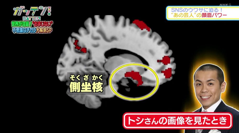 當她們看到Toshi的照片時，可以見到腦部有著紓緩痛楚作用的「伏隔核」竟然變得活躍起來。