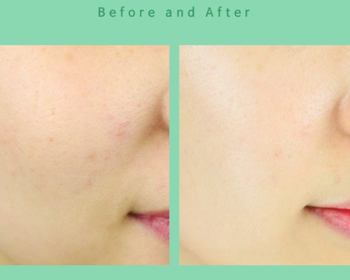 同時亦能達至水油平衡的效果，所以是韓國女生必備的肌膚清潔用品。