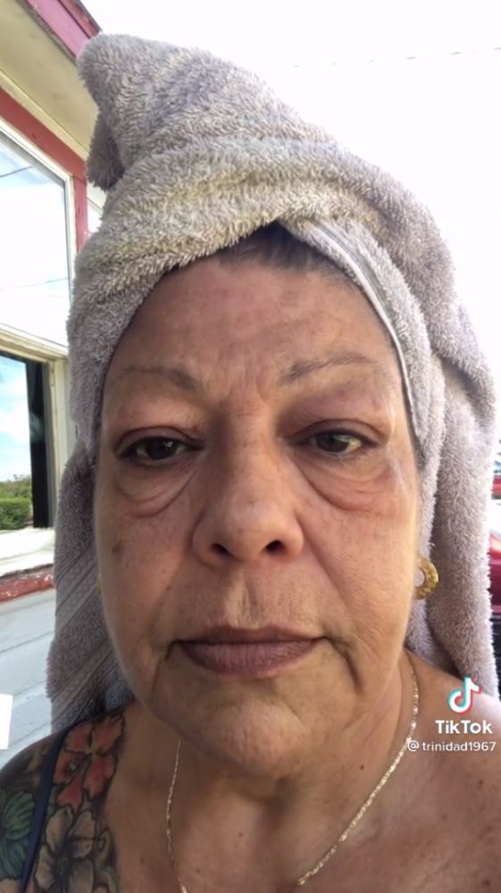 而爆紅的實測影片由54歲@trinidad1967 於 TikToker上發布。從影片可見，她有非常明顯的眼袋下垂，導致眼下有幾條深皺紋。