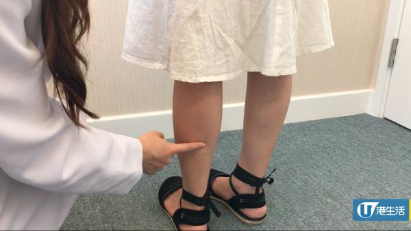 日日坐冷氣房易水腫！中醫師教你3大去濕穴位