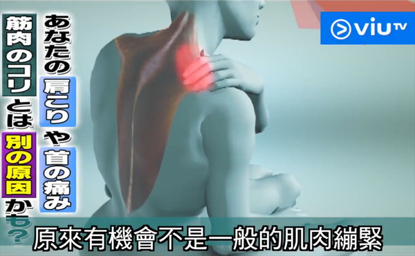 【肩頸痛原因】肩頸痠痛未必是肌肉緊繃！一招檢查受壓神經+醫生改善建議