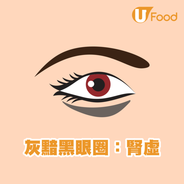 【黑眼圈】中醫教你分辨黑眼圈顏色代表什麼／3個熱敷方法去黑眼圈　鼻敏感是青色