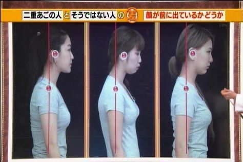 【健康減肥】日本專家全面分析雙下巴成因／解決方法　1個超簡易懶人瘦面法／每日10分鐘快速踢走包包面