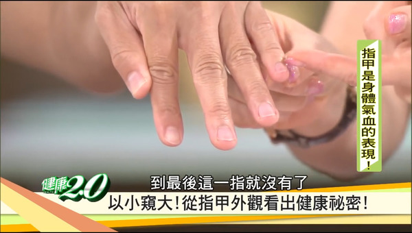 【指甲健康】 指甲直紋／凹陷／白點代表什麼？ 醫生解答15大指甲狀況與健康關係＋養甲茶療推介