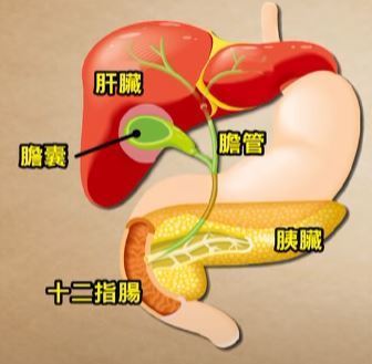 傳雪妮患胰臟癌飽受折磨需長期住院  警惕胰臟癌7大危險病徵有一症狀已屬晚期