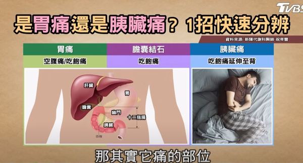 傳雪妮患胰臟癌飽受折磨需長期住院  警惕胰臟癌7大危險病徵有一症狀已屬晚期