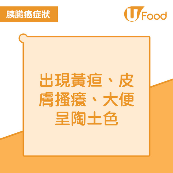傳雪妮患胰臟癌飽受折磨需長期住院  警惕胰臟癌7大危險病徵有一症狀已屬晚期