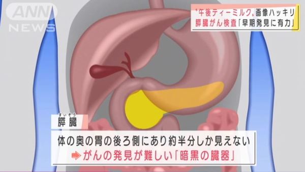 傳雪妮患胰臟癌飽受折磨需長期住院  警惕胰臟癌7大危險病徵有一症狀已屬晚期