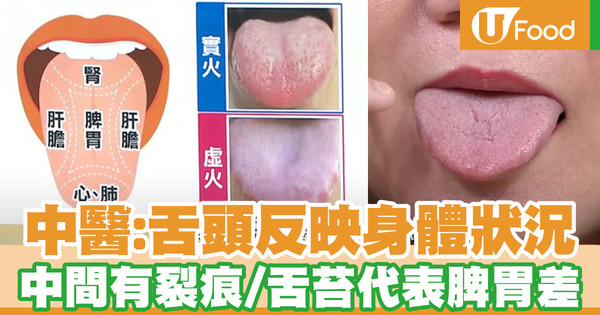 舌頭反映身體狀況 中醫：中間有裂痕／舌苔代表脾胃差