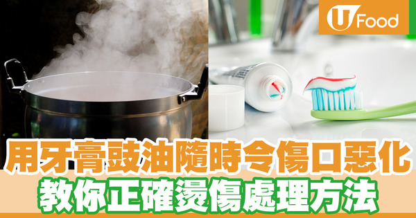 燙傷用牙膏豉油隨時令傷口惡化！ 一文教你正確燙傷處理方法