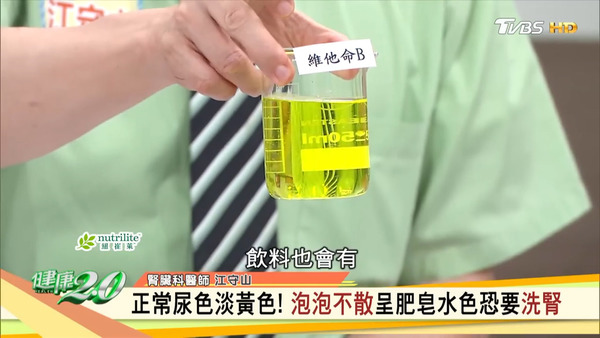 尿液顏色並非越淡越好！　台灣醫生教你從6種排尿問題看出身體警號