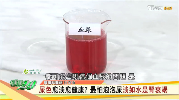 尿液顏色並非越淡越好! 台灣醫生教你從6種排尿問題看出身體警號