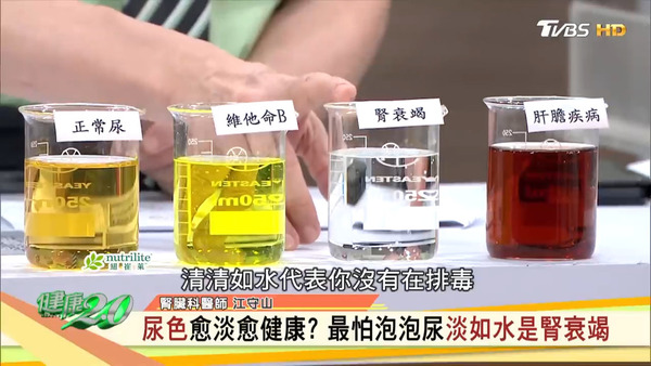 尿液顏色並非越淡越好！　台灣醫生教你從6種排尿問題看出身體警號