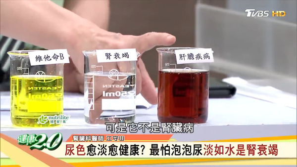 尿液顏色並非越淡越好! 台灣醫生教你從6種排尿問題看出身體警號