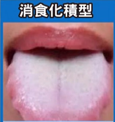 25歲女愛喝珍珠奶茶不愛運動患上嚴重口臭　中醫教你從舌頭情況分辨4種口臭