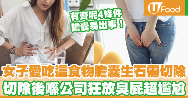 42歲女愛吃這食物膽囊生石需切除 及後公司狂放臭屁超尷尬／4條件易生膽結石