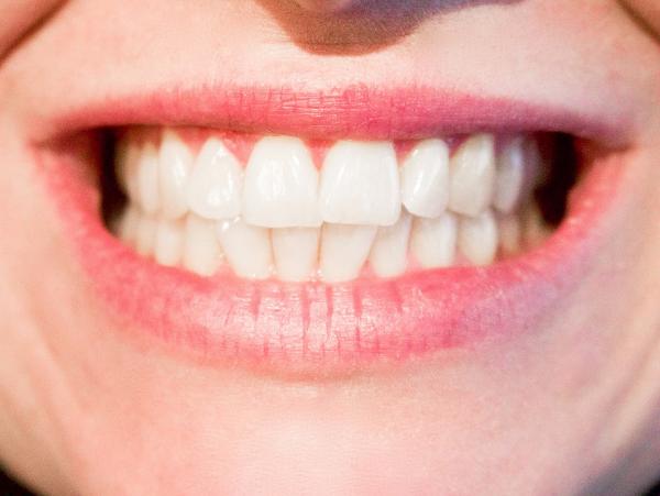 美國研究指部分牙線含潛在有毒物質 長期使用或令體內毒素增加