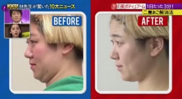 瞓錯枕頭有機會導致雙下巴！日本專家教你5秒瘦臉操 快速變尖臉