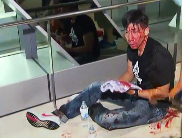 前TVB主播柳俊江前往元朗疏散乘客卻遭毆打 血流披面入院報平安撰長文抒發感受