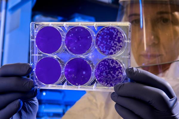 【新冠肺炎】病毒可在物體表面存活9日 德國研究：3種成分有效消毒清潔