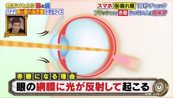 森岡清史醫生指，因為人類瞳孔在黑暗環境下會放大，令更多光線可以進入視網膜後方。