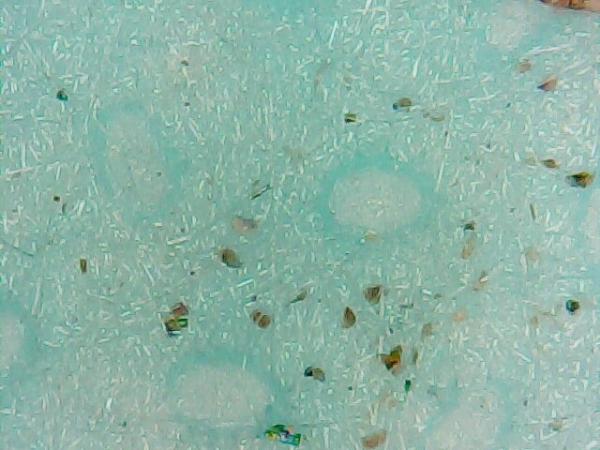 【新冠肺炎】化學博士K Kwong驗一款疑港產口罩 用顯微鏡放大驚現毛髮加碎昆蟲