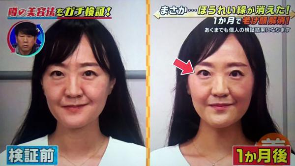日本節目實測「扮鬼臉」美容法 3組簡單動作減法令紋、魚尾紋一個月可見效