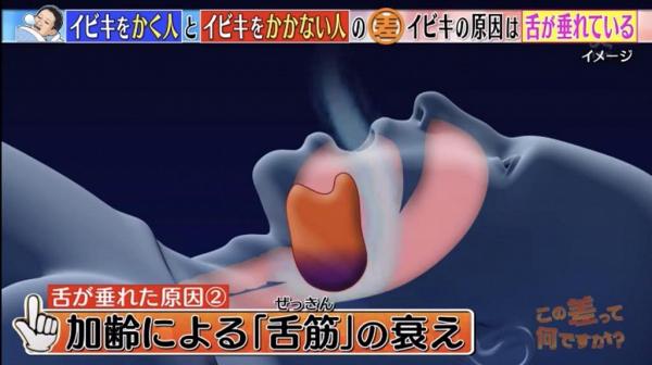 日本節目睡眠專家教1招解決鼻鼾問題 提醒3類人士較易患上睡眠窒息症！