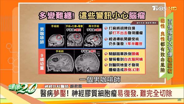 台灣男子打牌成日都輸其實係因為有病？ 醫生解釋病因出現6大病徵要及早檢查