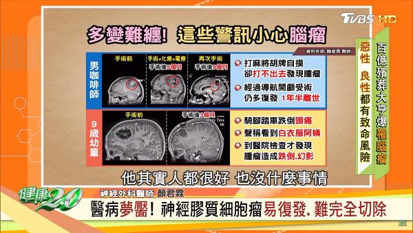 台灣男子打牌成日都輸其實係因為有病？ 醫生解釋病因出現6大病徵要及早檢查
