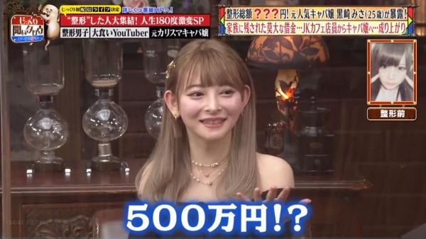 當時單時鼻子上的整容手術就花費了500萬日圓（約36萬）