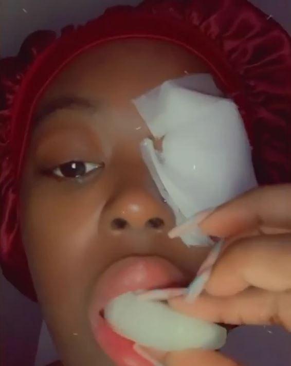 iPhone手機充電線損壞照用終爆炸 19歲少女火花彈入眼致眼角膜灼傷
