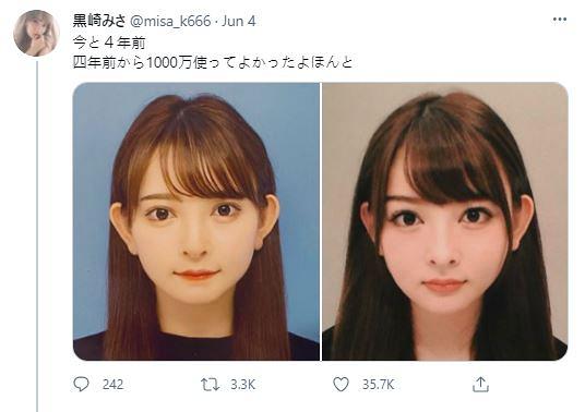 日本模特兒豪花1000萬円整容 公開4年前對比照網民驚訝：有咩分別？