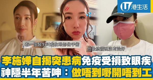 李施嬅自揭患上自體免疫系統疾病致眼疾 曾接受手術治療已停工半年苦呻：做唔到嘢開唔到工