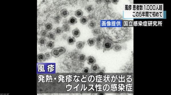 日本 德國麻疹
