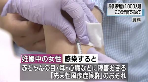 日本 德國麻疹