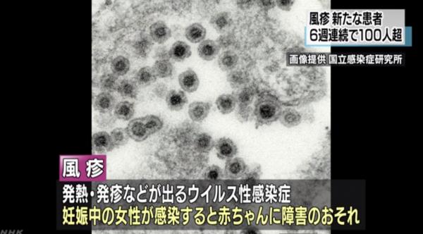 日本德國麻疹