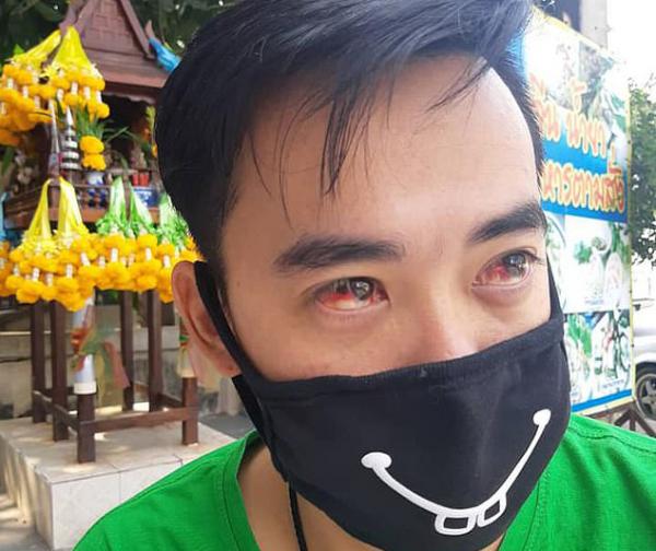 泰國毒霧霾威脅健康 居民打噴嚏流鼻血、眼睛充血