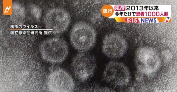 日本德國麻疹個案飆升 今年過1000人感染創6年來新高