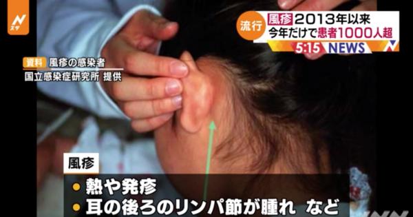 日本德國麻疹個案飆升 今年過1000人感染創6年來新高