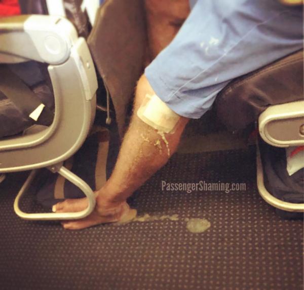 乘客未包紮好傷口上機 膿液由腿部流到機艙地毯極度噁心