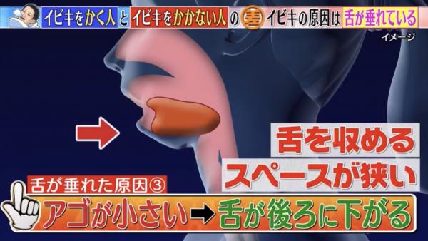 下巴細較易會打鼻鼾？ 日本睡眠專家教2招改善鼻鼾