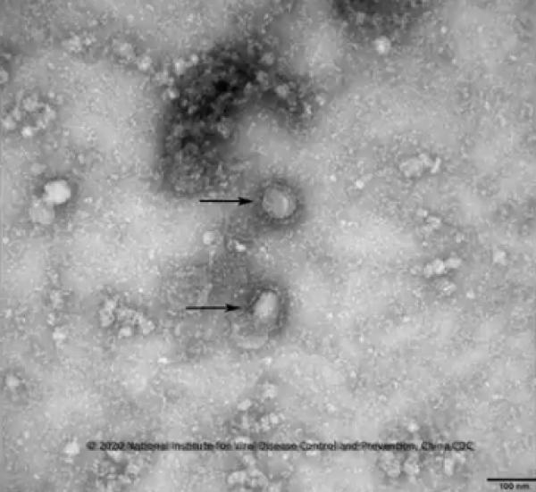 日本第2宗本地感染個案 奈良籍司機同團導遊確診武漢肺炎