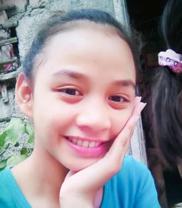 菲律賓17歲少女手擠黑頭變毀容 引發怪病面部腫脹變象鼻壓迫雙眼
