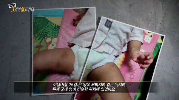 韓國1歲養女遭養父母虐待致死引民憤 多處內臟破裂﹑全身骨折﹑嚴重內出血 養母﹕只是輕輕打