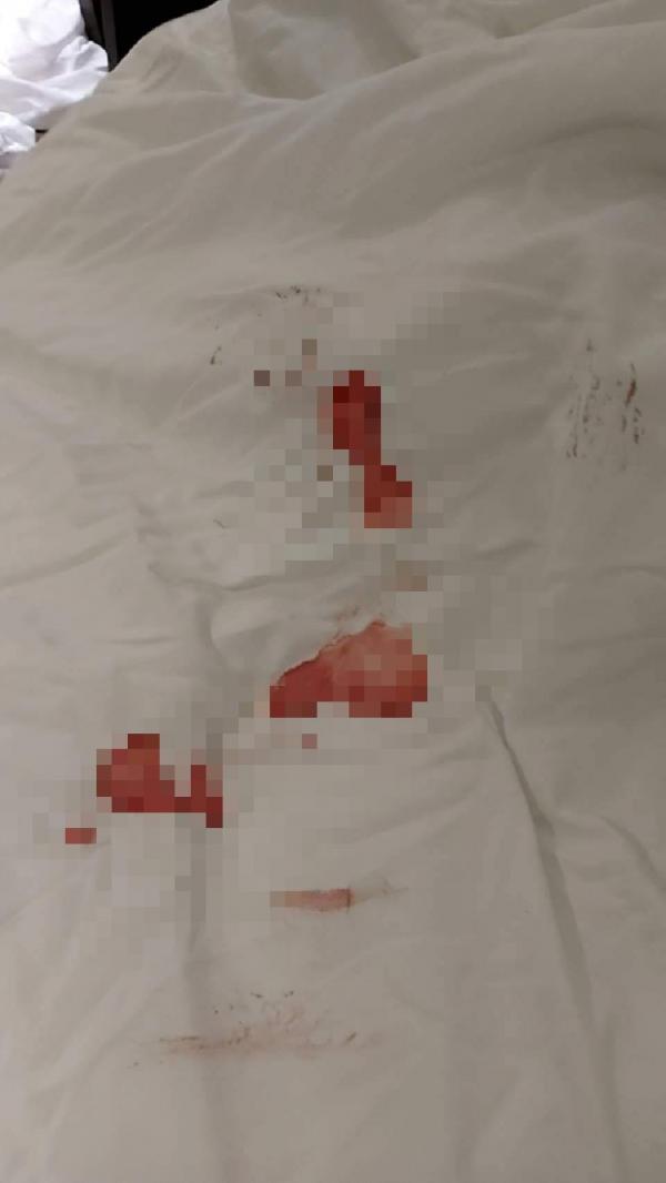 情侶住酒店床上遺下大片血跡 稱月經到讓員工崩潰：買衛生巾好難？