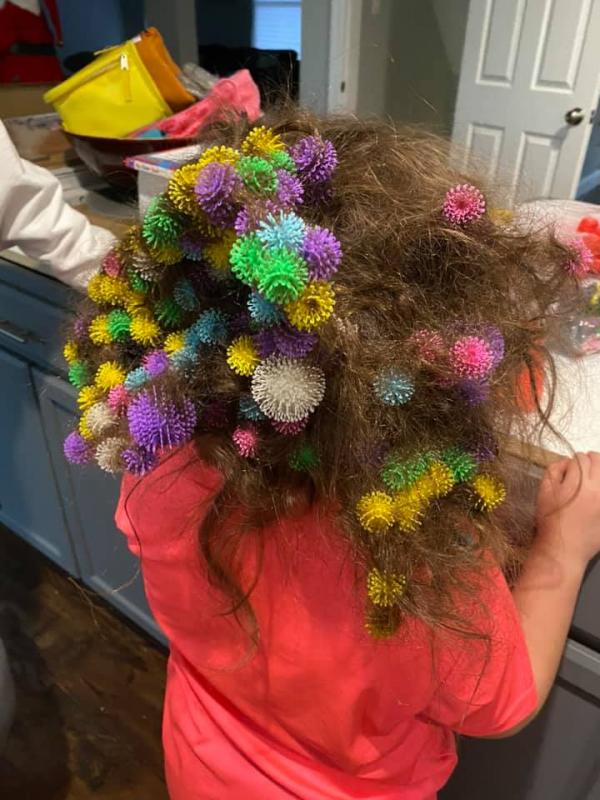 美國6歲女孩頭髮意外纏滿150個黏貼球 媽媽怕剪髮令女兒傷心 花20小時逐一解開