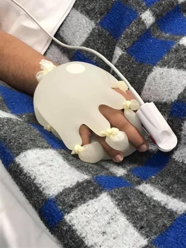 巴西護士自製「十指緊扣」神器 安撫隔離病人孤獨的心！